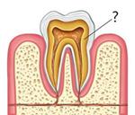 οδοντινη